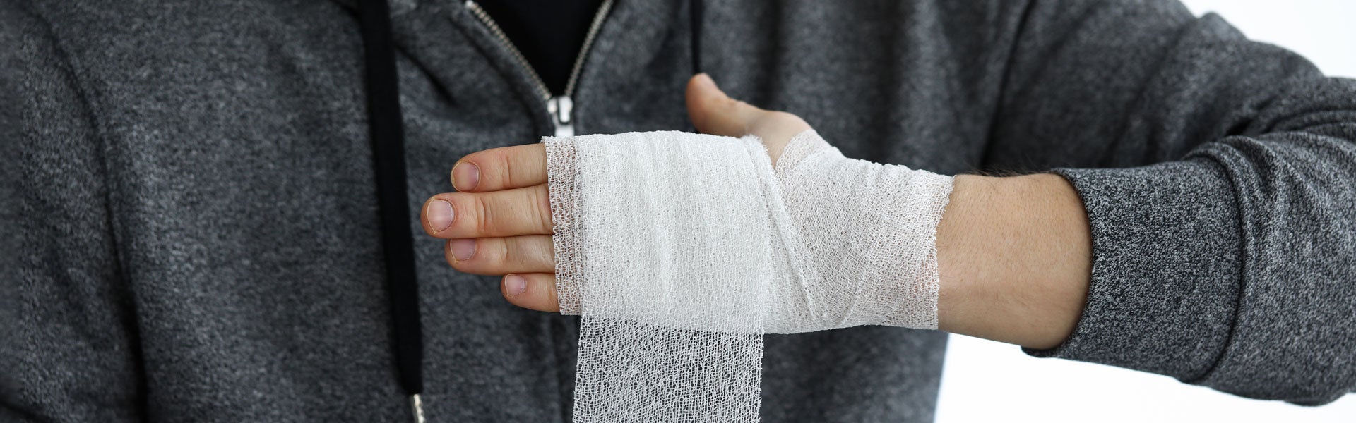 Burn Injury